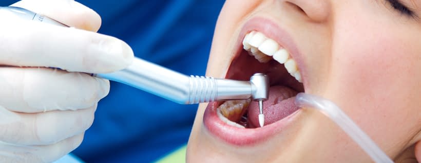 Affordable Dental Treatment